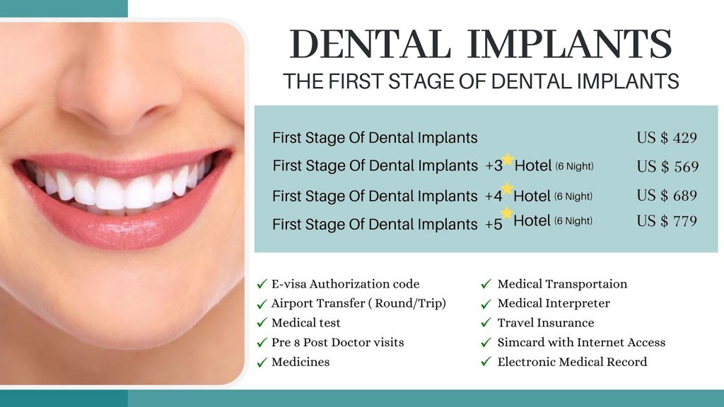 dental.final.implant-min