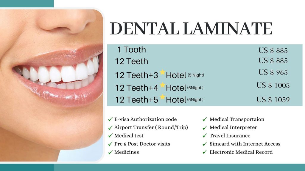 laminate.final-min