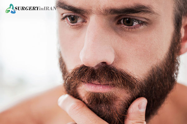 Beard implants in men